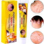 SUMIFUN Maść na Swędzenie Wypryski Skóry Łuszczycę 20g